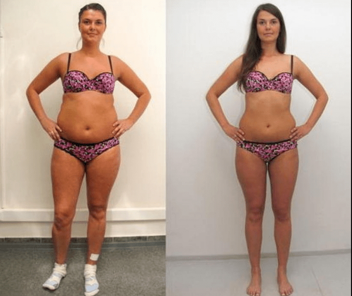 Egy lány, aki 6 kg-ot fogyott 7 napos hajdina diétával